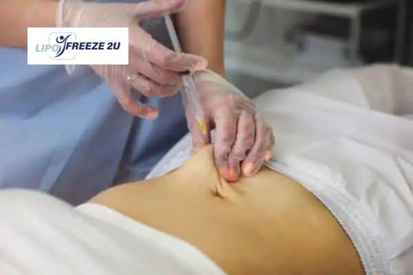 How Does Aqualyx Fat Dissolving Injection Work to Break Down Fat Brackley?