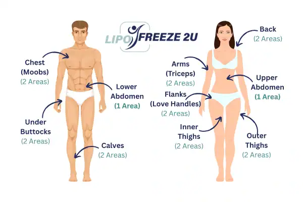Areas you can have fat freezing treatment Brackley